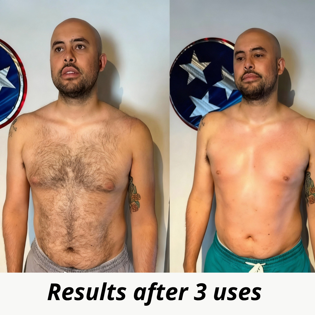 Opula - Permanent Hair Reduction Serum