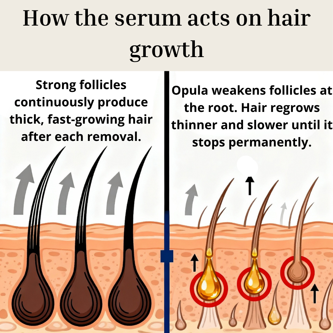 Opula - Permanent Hair Reduction Serum