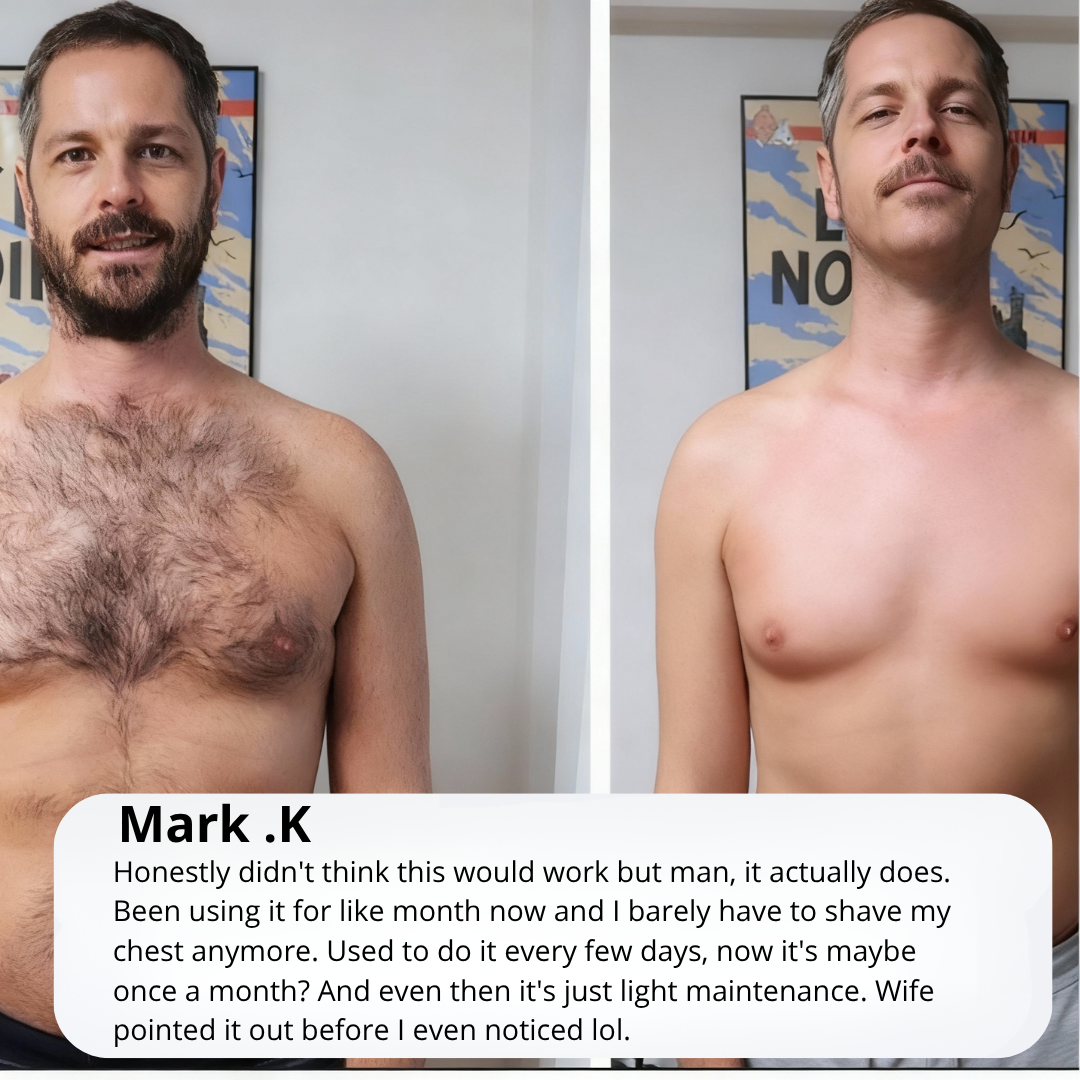 Opula - Permanent Hair Reduction Serum